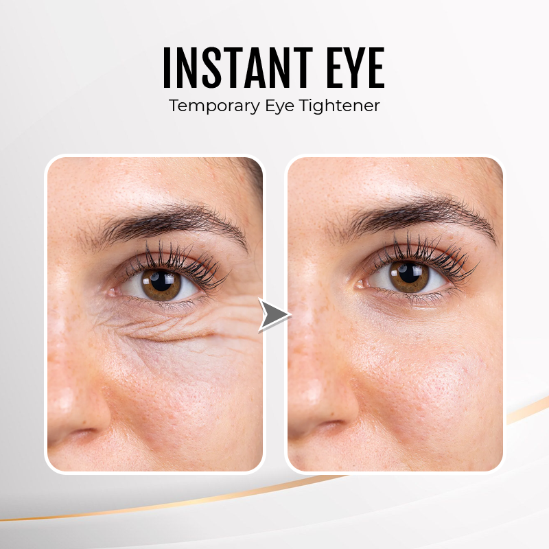 (🎄Christmas Event-50%off🎁)Instant Wrinkle Eye Tightener cream✨
