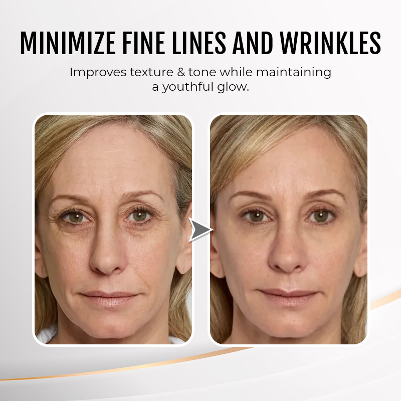 (🎄Christmas Event-50%off🎁)Instant Wrinkle Eye Tightener cream✨