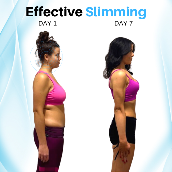 (🔥LAST DAY SALE-80% OFF)Histone Acupressure Slimming Earrings