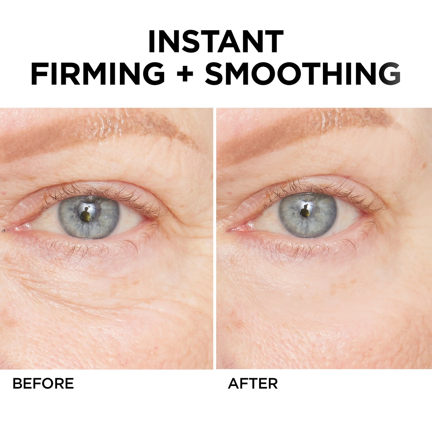 (🎄Christmas Event-50%off🎁)Instant Wrinkle Eye Tightener cream✨