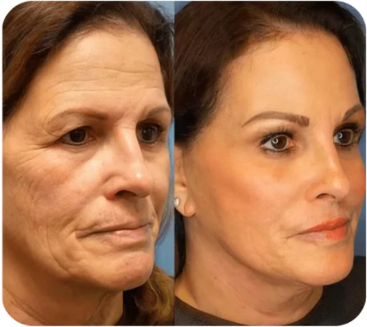 Perfection Primer Tightener – Ultimate Lift & Smooth Finish