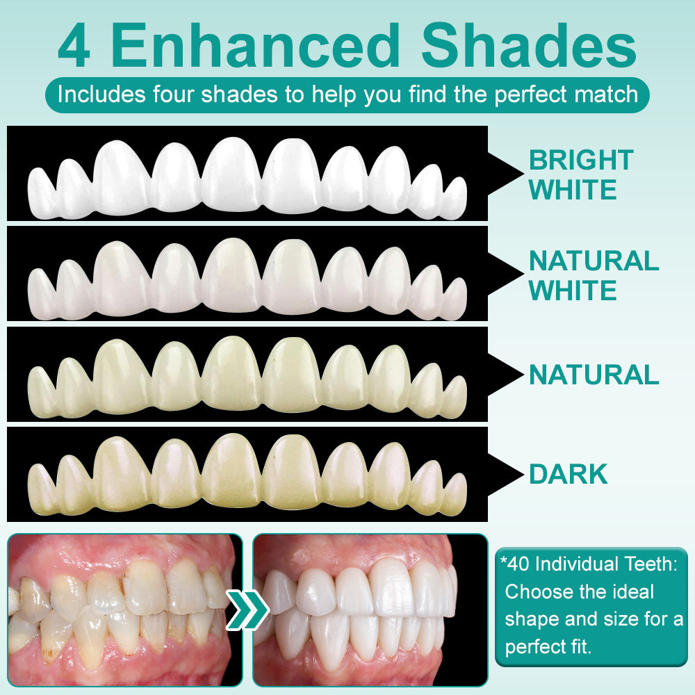 🦷Medazy® Instant Stick-on Dental Veneers (✅Clinically proven, easy-to-use dental veneers trusted by over 8,000 US users for a comfortable, natural smile.)