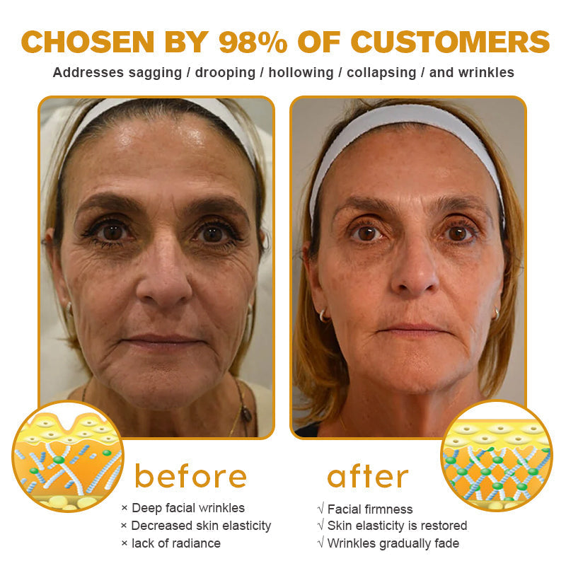 ✨[Official Store]✨ LOVILDS™ Botulin Bee Poison Wrinkle Removal Cream