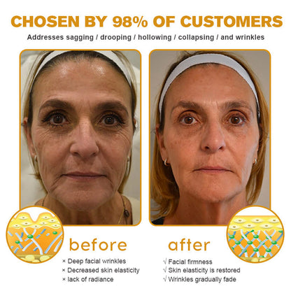 ✨[Official Store]✨ LOVILDS™ Botulin Bee Poison Wrinkle Removal Cream